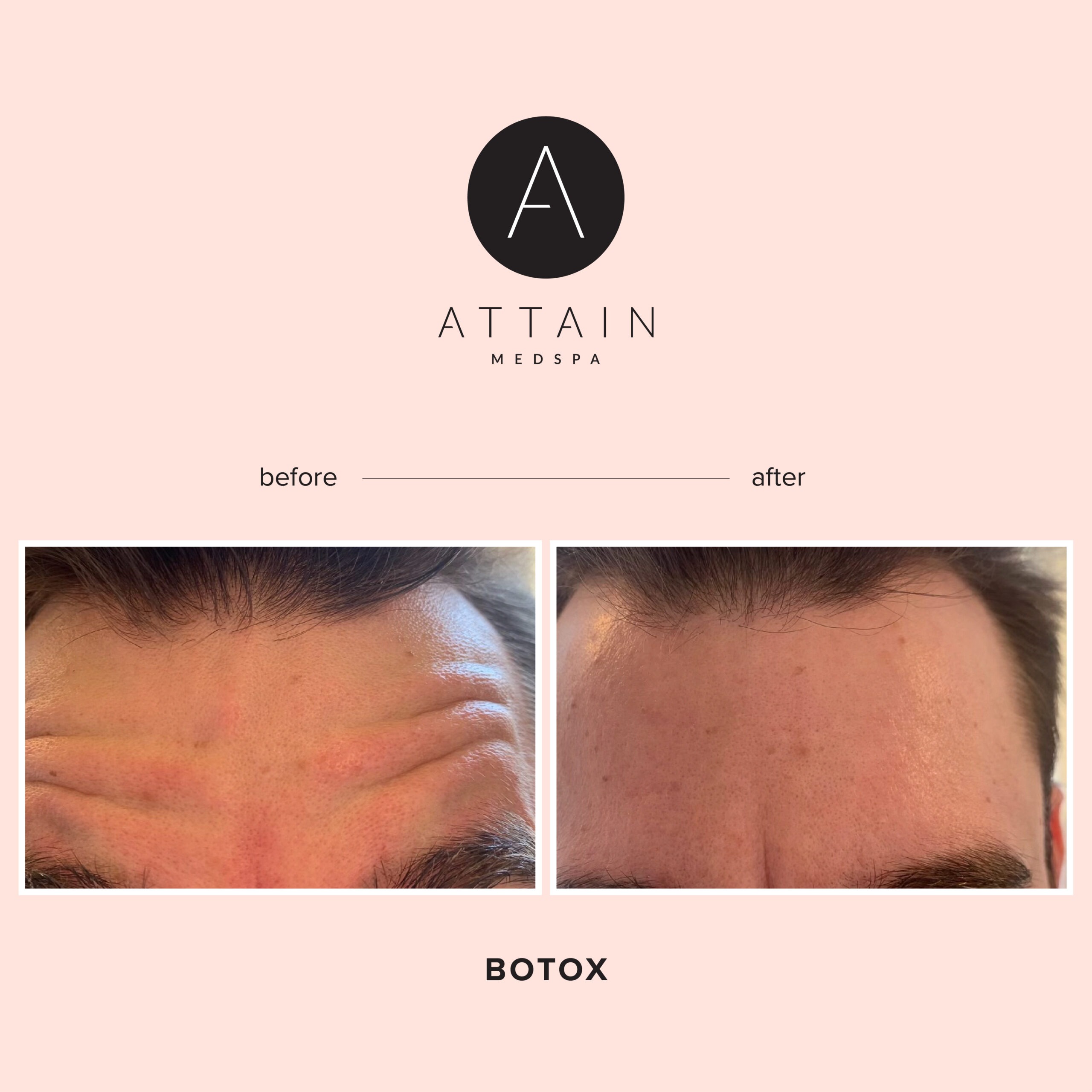 Attain_BeforeAfter_2-01
