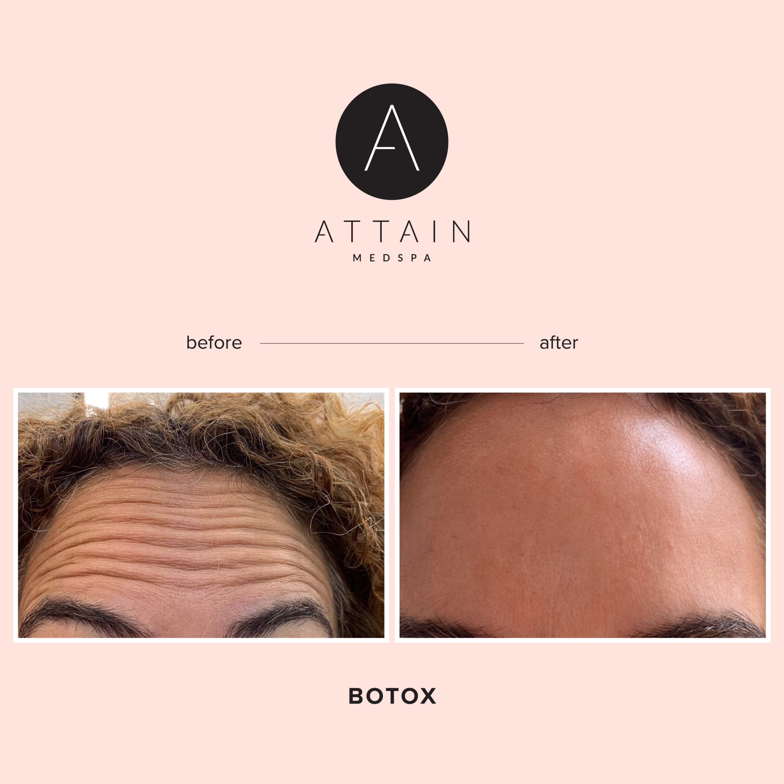 Attain_BeforeAfter_2-04